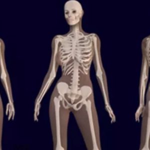 Scientist Reveal What Cannabis Does to Your Bones…